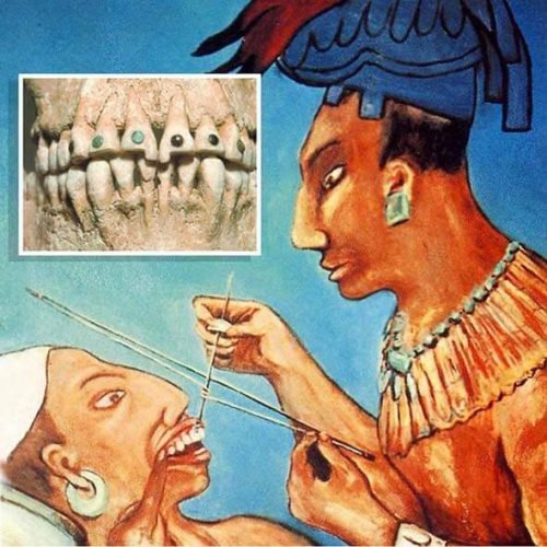 История профессии стоматолог (индейцы)